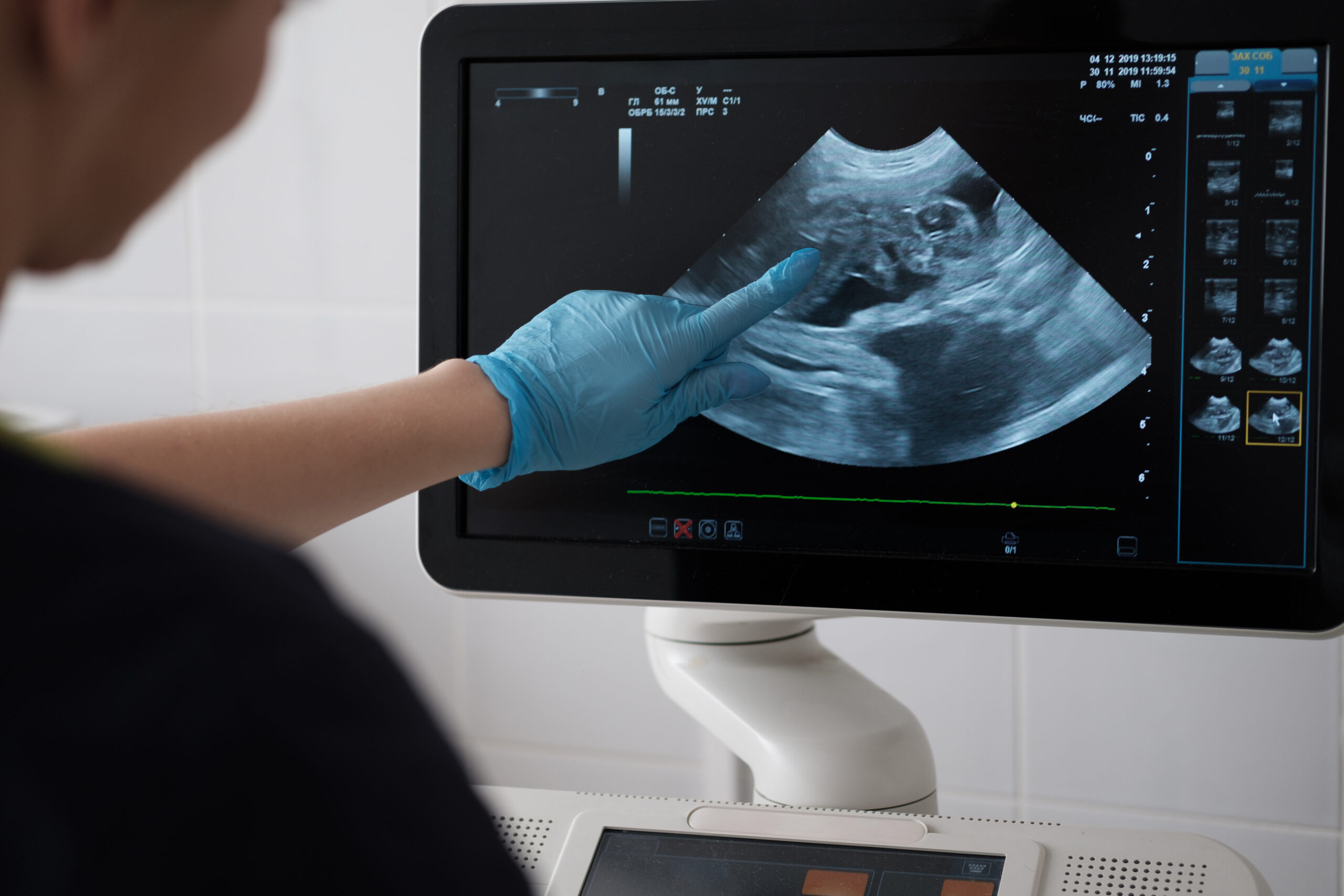 Un medico veterinario della Clinica Veterinaria Stazione controlla un'ecografia per il servizio veterinario di diagnostica per immagini